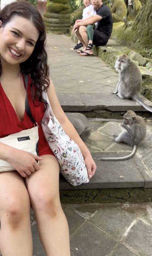 bitten by monkeys in Bali